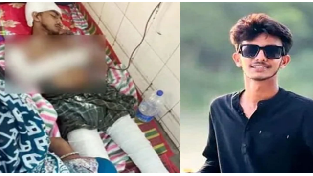 মানিকগঞ্জে ইটভাটায় ডেকে ছাত্রলীগ নেতার হাত-পায়ের রগ কাটার অভিযোগ, ৪ বন্ধুর বিরুদ্ধে মামলা
